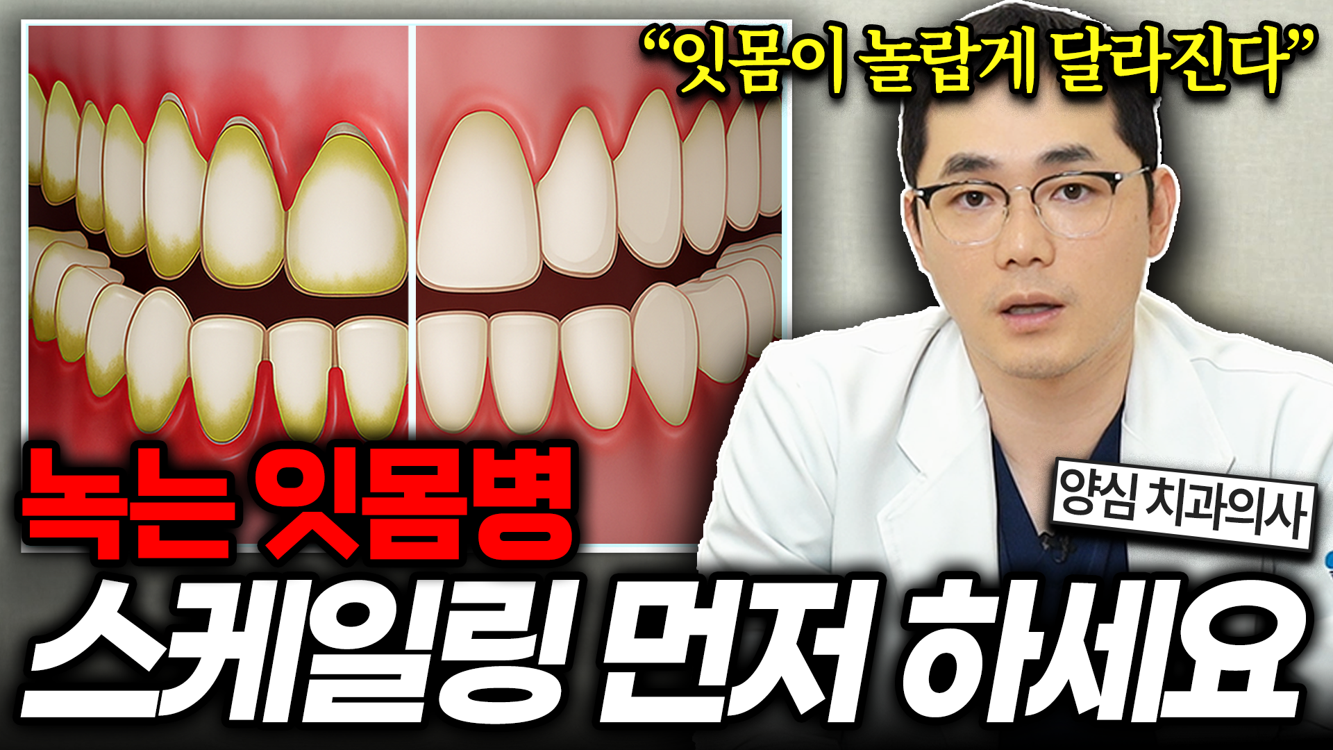 유튜브 썸네일 1