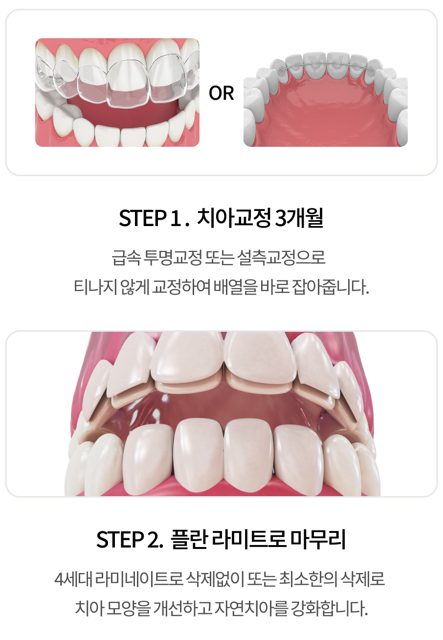 치료 과정 1단계 모바일